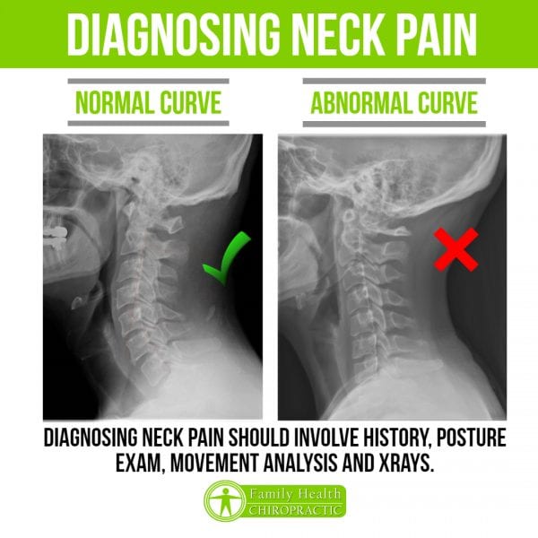 Neck Pain Symptoms, Causes, Treatment Family Health Chiropractic