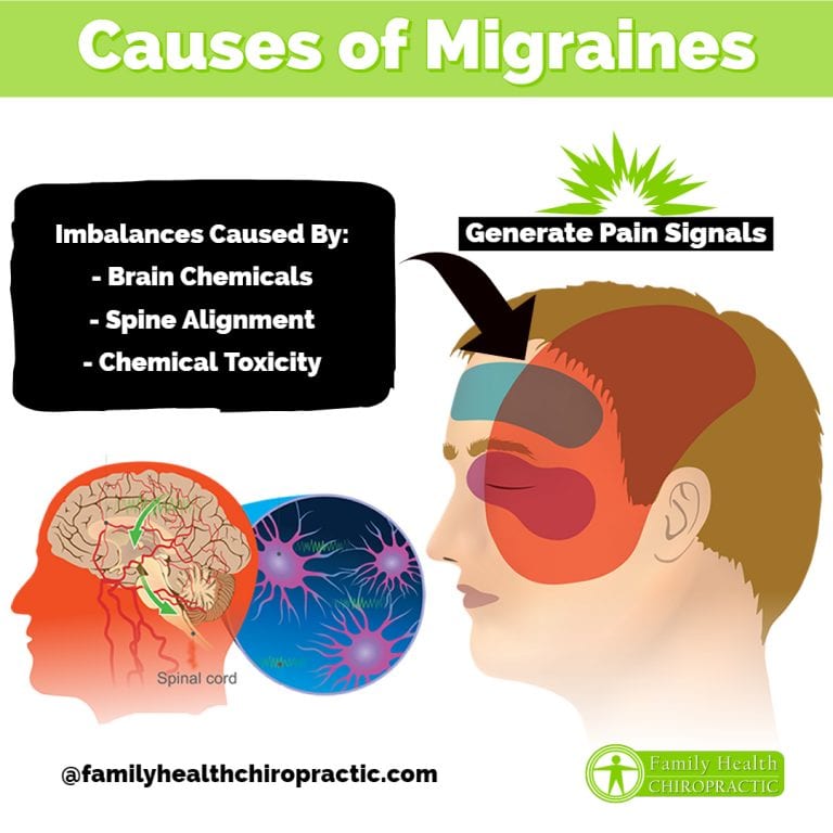 What Causes Migraines?