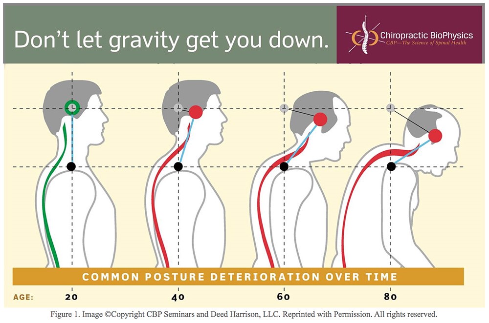 Poor Posture Affects More Than Your Appearance - Cianci Chiropractic Center