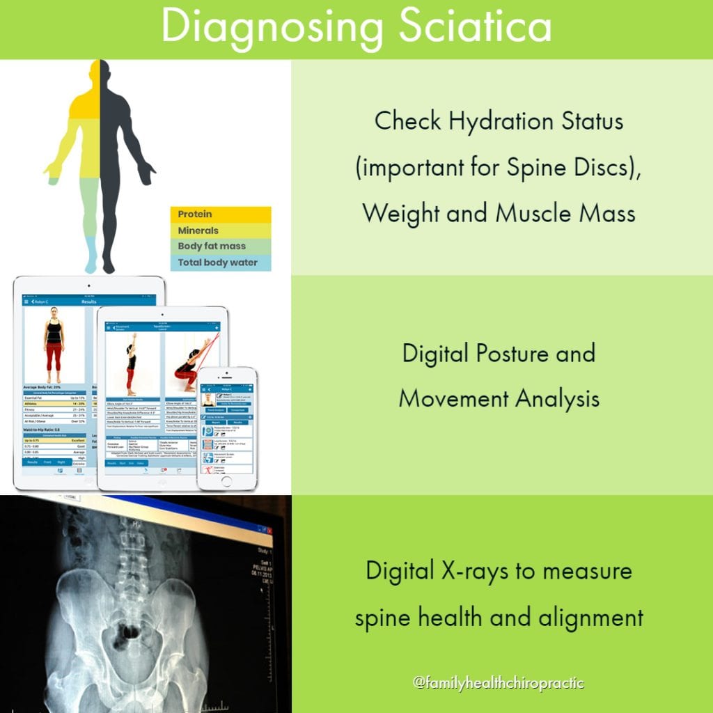 examination of sciatica