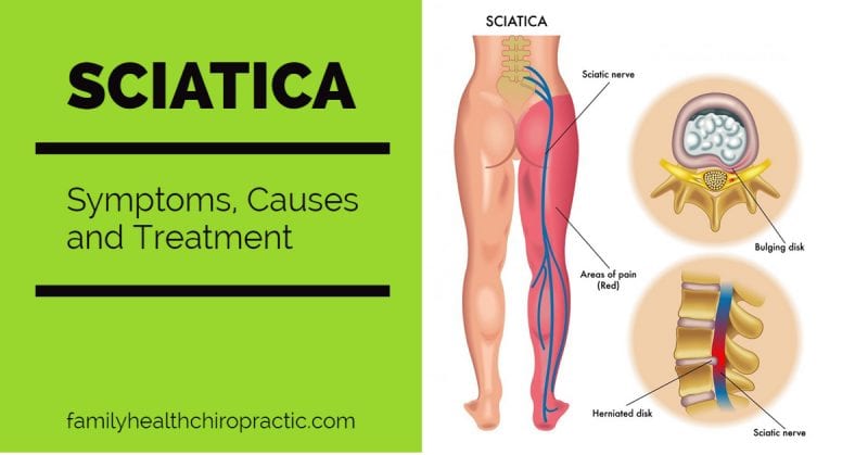 Austin Chiropractor Sciatica Treatment In Austin Texas