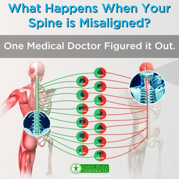 Shocking Results From a Medical Doctor Wanting to Disprove Chiropractic ...