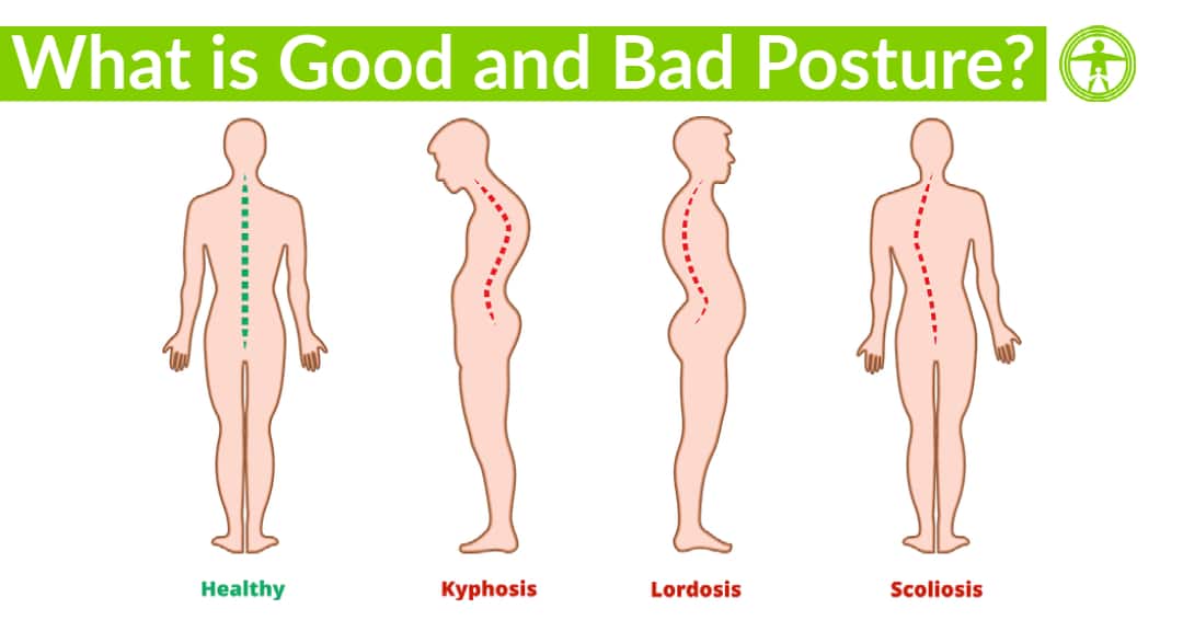 Austin Chiropractor  Myths About Good and Bad Posture